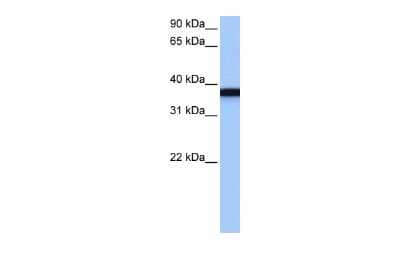 Western Blot: GSG1 Antibody [NBP2-84055]