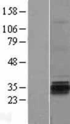 Western Blot: GSG1 Overexpression Lysate [NBP2-04398]