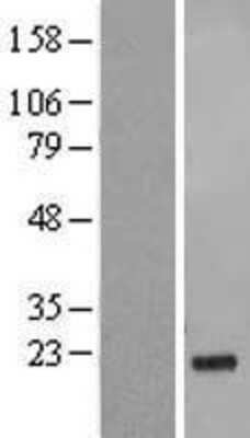 Western Blot: GSG1L Overexpression Lysate [NBL1-11360]