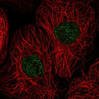 Immunocytochemistry/ Immunofluorescence: GSG2 Antibody [NBP2-55174]