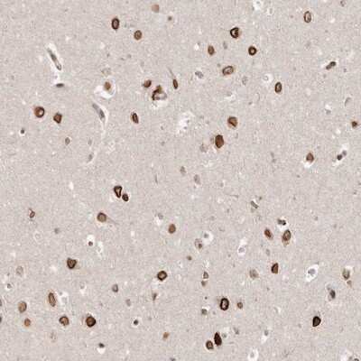 Immunohistochemistry-Paraffin: GSG2 Antibody [NBP1-81774]