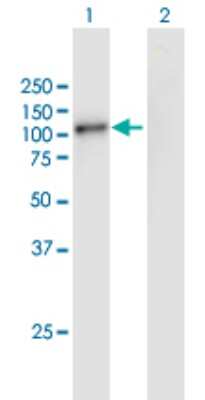 Western Blot: GSG2 Antibody [H00083903-B01P]