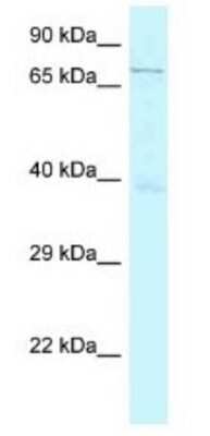 Western Blot: GSG2 Antibody [NBP1-79837]