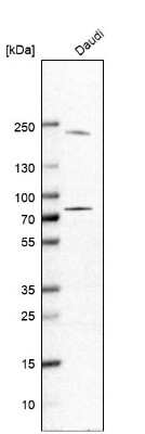 Western Blot: GSG2 Antibody [NBP1-81774]