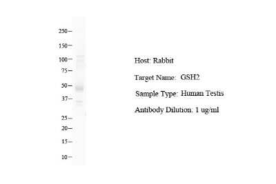 Western Blot: GSH2 Antibody [NBP2-86661]