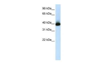 Western Blot: GSH2 Antibody [NBP2-86662]