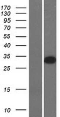 Western Blot: GSH2 Overexpression Lysate [NBL1-11380]