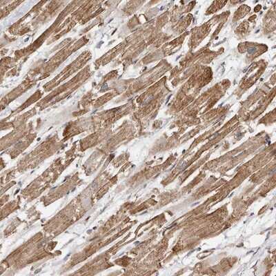 Immunohistochemistry-Paraffin: GSK-3 alpha Antibody [NBP1-87445]
