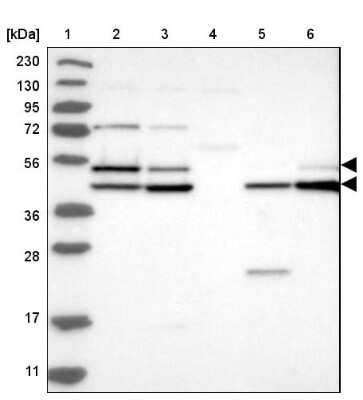 Western Blot: GSK-3 alpha Antibody [NBP1-87445]