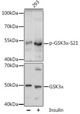 Western Blot: GSK-3 alpha/beta [p Ser21] AntibodyAzide and BSA Free [NBP3-05443]