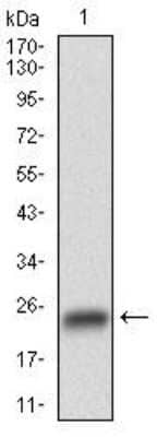 Western Blot: GSK-3 beta Antibody (3D6B4)BSA Free [NBP2-52478]