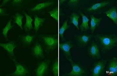 Immunocytochemistry/ Immunofluorescence: GSK-3 beta Antibody (GT1619) [NBP3-13691]