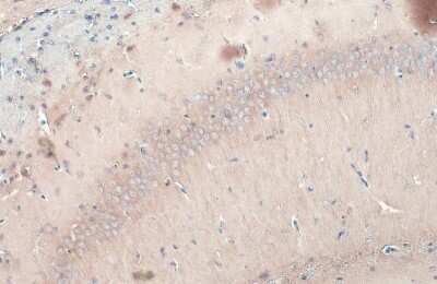 Immunohistochemistry-Paraffin: GSK-3 beta Antibody (GT1619) [NBP3-13691]