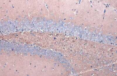 Immunohistochemistry-Paraffin: GSK-3 beta Antibody (GT1619) [NBP3-13691]