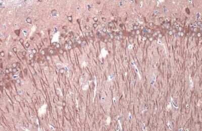 Immunohistochemistry-Paraffin: GSK-3 beta Antibody (GT1619) [NBP3-13691]