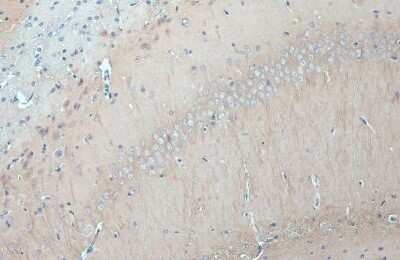 Immunohistochemistry-Paraffin: GSK-3 beta Antibody (GT16711) [NBP3-13679]