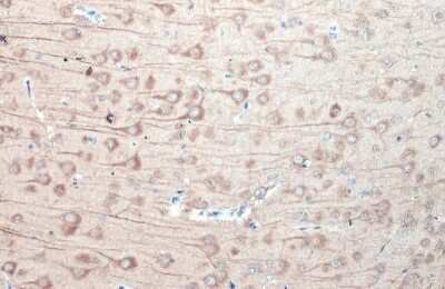 Immunohistochemistry-Paraffin: GSK-3 beta Antibody (GT16711) [NBP3-13679]
