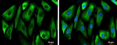 Immunocytochemistry/ Immunofluorescence: GSK-3 beta Antibody [NBP1-31353]