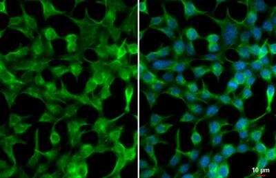 Immunocytochemistry/ Immunofluorescence: GSK-3 beta Antibody [NBP1-31353]