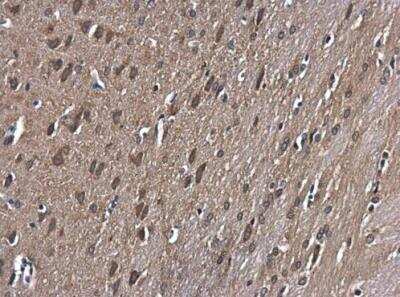 Immunohistochemistry-Paraffin: GSK-3 beta Antibody [NBP1-31353]