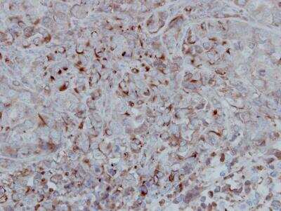 Immunohistochemistry-Paraffin: GSK-3 beta Antibody [NBP1-31353]