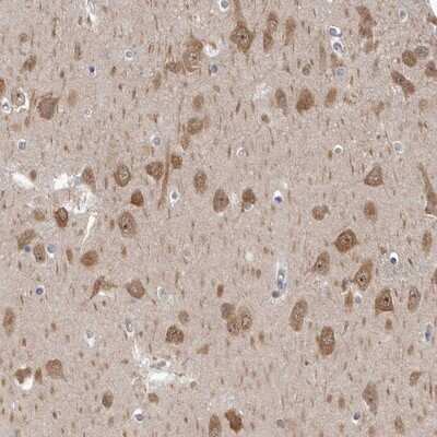 Immunohistochemistry-Paraffin: GSK-3 beta Antibody [NBP1-90359]