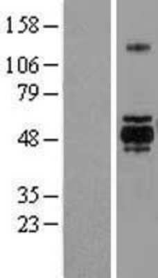 Western Blot: GSK-3 alpha Overexpression Lysate [NBL1-11361]