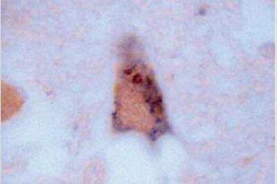 Immunohistochemistry-Paraffin: GSK-3 alpha/beta Antibody (1H8) [NB110-85523]