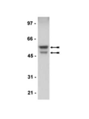 Western Blot: GSK-3 alpha/beta Antibody (L5) [NBP2-29873]