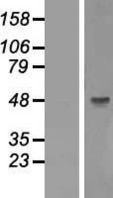 Western Blot: GSK-3 beta Overexpression Lysate [NBL1-11362]