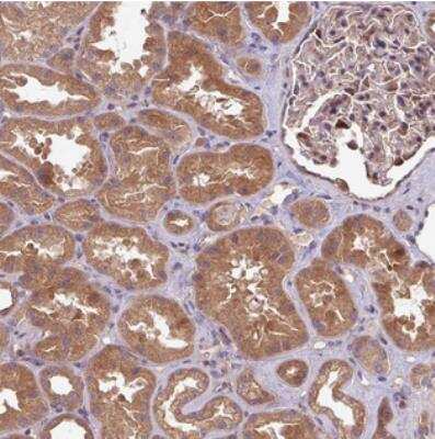 Immunohistochemistry: GSKIP Antibody [NBP2-30680]
