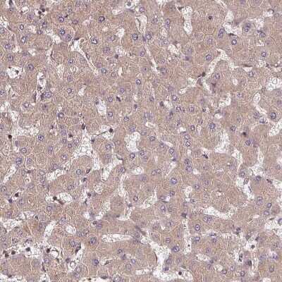 Immunohistochemistry-Paraffin: GSKIP Antibody [NBP2-30680]