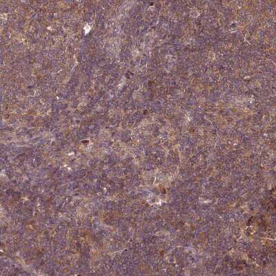 Immunohistochemistry-Paraffin: GSKIP Antibody [NBP2-30680]
