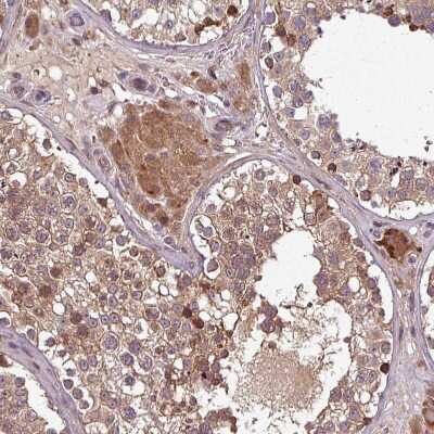 Immunohistochemistry-Paraffin: GSKIP Antibody [NBP2-30680]