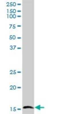 Western Blot: GSKIP Antibody [H00051527-B01P]