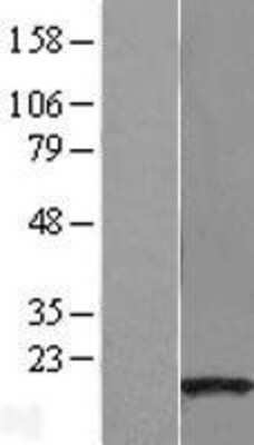 Western Blot: GSKIP Overexpression Lysate [NBL1-08173]