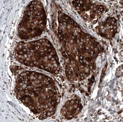 Immunohistochemistry-Paraffin: GSPT1 Antibody (CL13332) [NBP3-18565]
