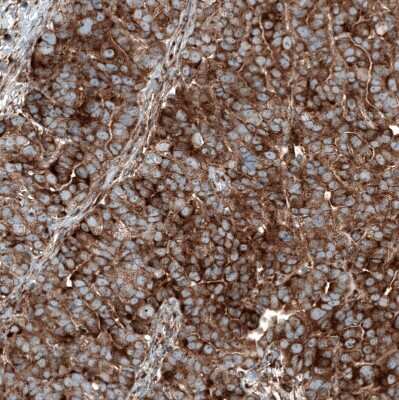 Immunohistochemistry-Paraffin: GSPT1 Antibody (CL13332) [NBP3-18565]
