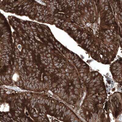Immunohistochemistry-Paraffin: GSPT1 Antibody (CL13332) [NBP3-18565]