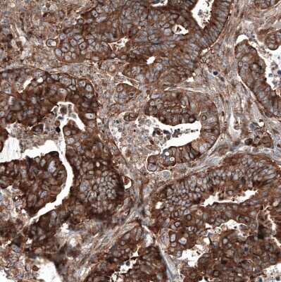 Immunohistochemistry-Paraffin: GSPT1 Antibody (CL13332) [NBP3-18565]