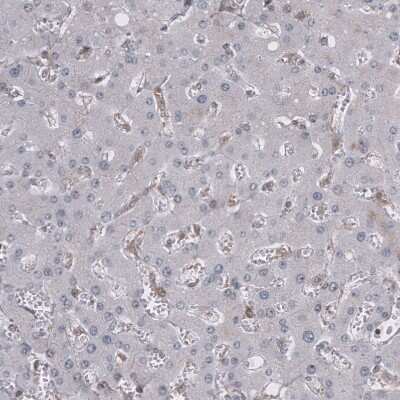 Immunohistochemistry-Paraffin: GSPT1 Antibody (CL13332) [NBP3-18565]