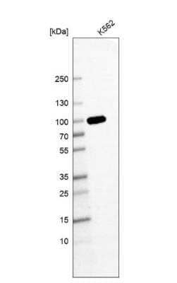 Western Blot: GSPT1 Antibody (CL13332) [NBP3-18565]