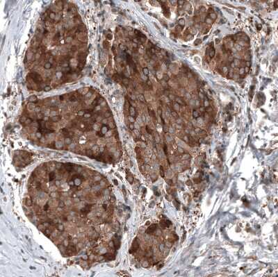 Immunohistochemistry-Paraffin: GSPT1 Antibody (CL13336) [NBP3-18559]