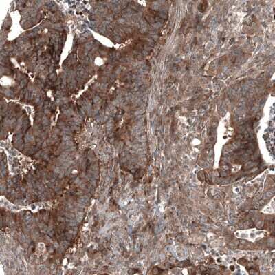 Immunohistochemistry-Paraffin: GSPT1 Antibody (CL13336) [NBP3-18559]