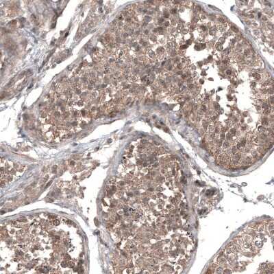 Immunohistochemistry-Paraffin: GSPT1 Antibody (CL13336) [NBP3-18559]