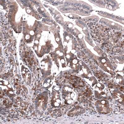 Immunohistochemistry-Paraffin: GSPT1 Antibody (CL13336) [NBP3-18559]