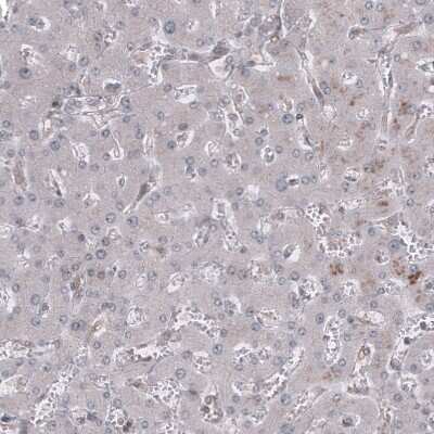 Immunohistochemistry-Paraffin: GSPT1 Antibody (CL13336) [NBP3-18559]