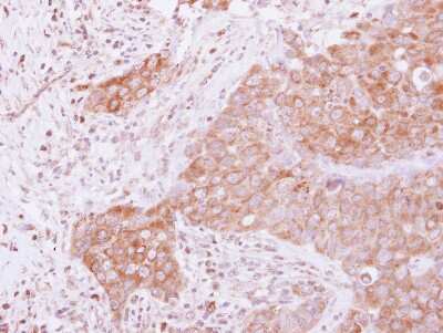 Immunohistochemistry-Paraffin: GSPT1 Antibody [NBP2-16754]