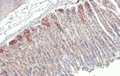 Immunohistochemistry-Paraffin: GSPT1 Antibody [NBP2-16754]