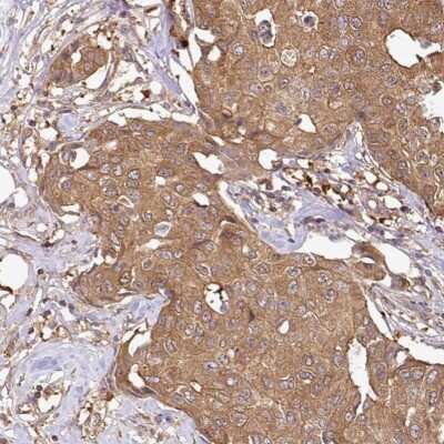 Immunohistochemistry-Paraffin: GSPT1 Antibody [NBP2-47442]